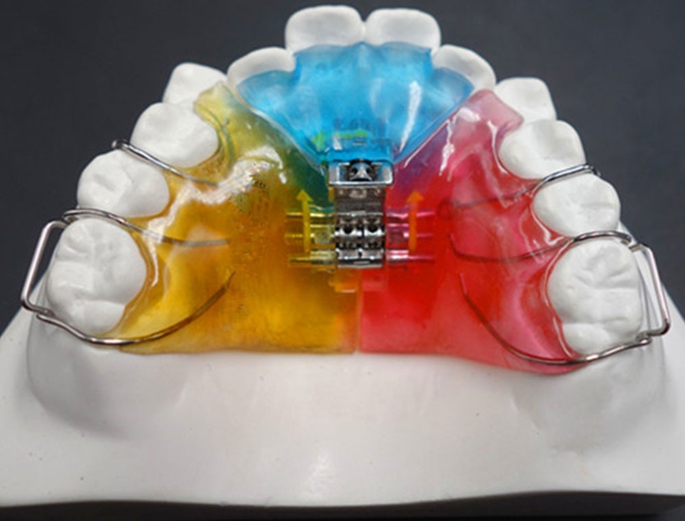 Orthodontische beugel