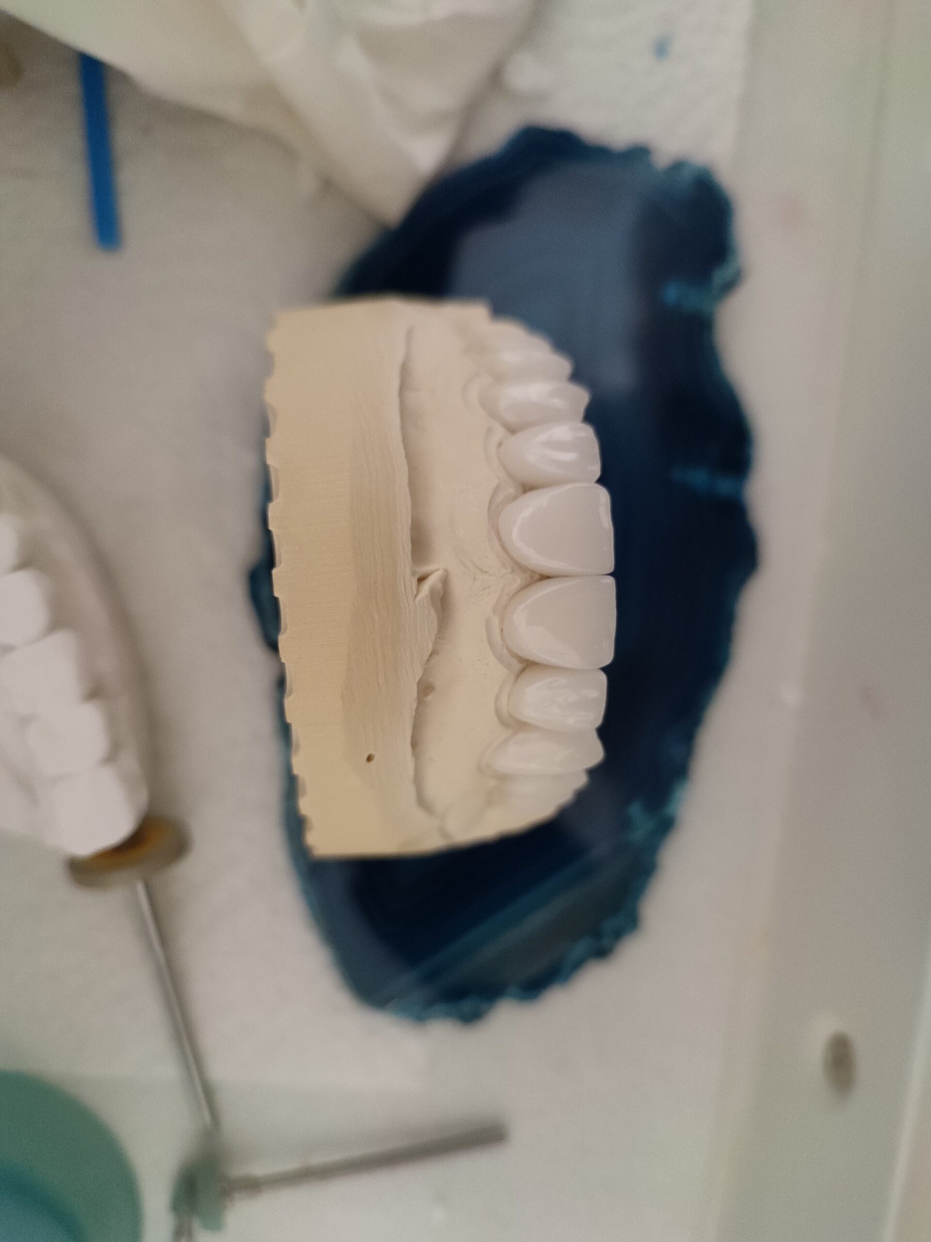 Tandtechnisch labo werk 44