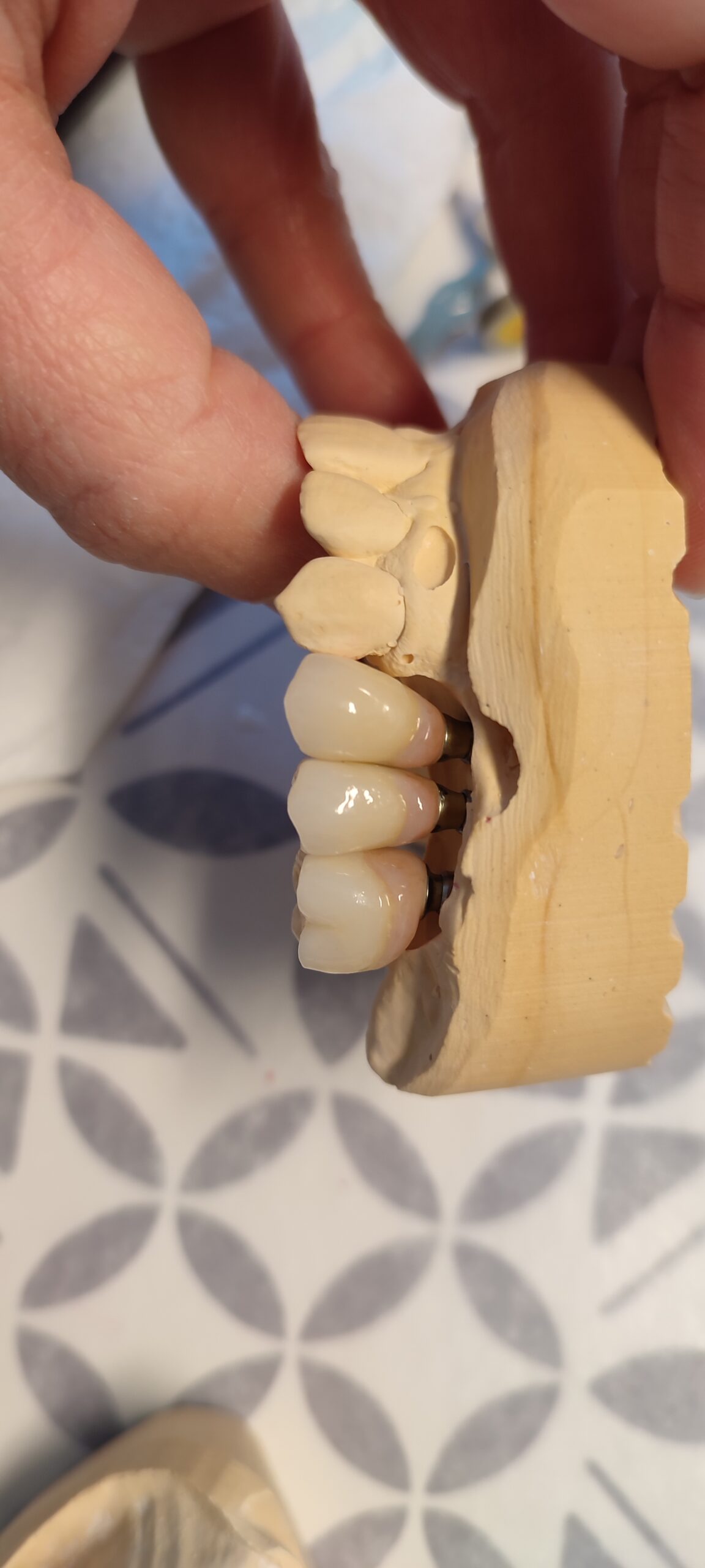 Tandtechnisch labo werk 26