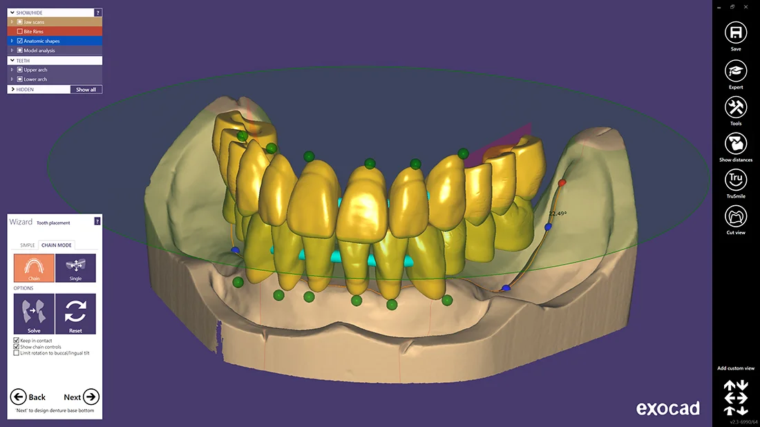 Digitaal ontwerp - Exocad tooth setup