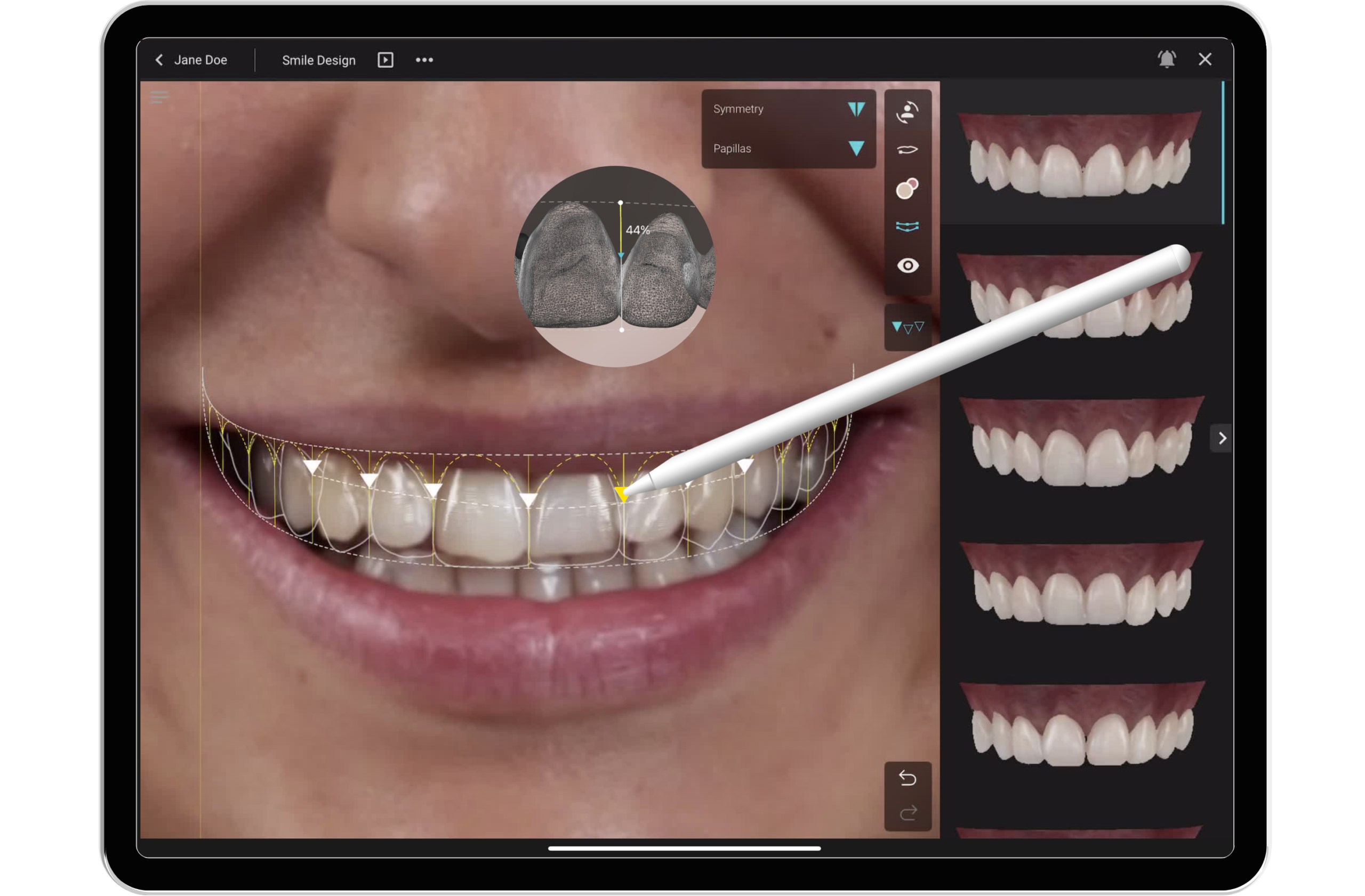 Conception numérique et Smile Cloud
